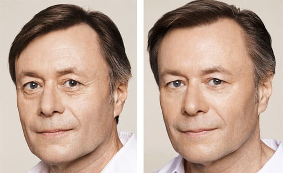 BBL Maryland Plastic Surgeon Bennett C. Yang